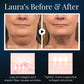 LIMETOW™ Sleeping V-Face Beauty Device
