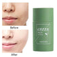 Skinetic™ Green Tea Deep Cleanse Mask