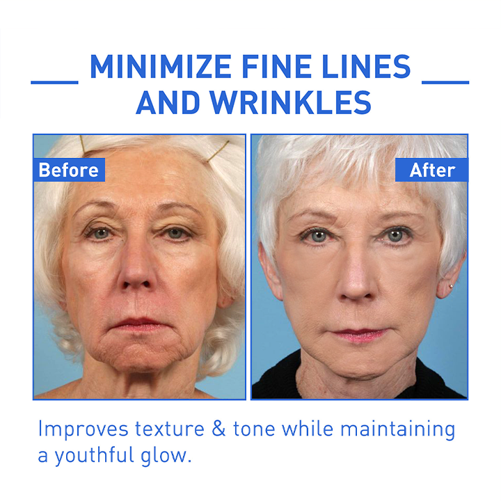 LIMETOW™ Botox Face Serum