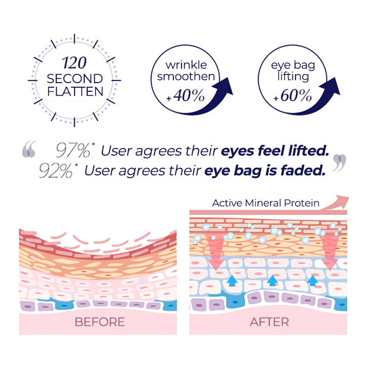 SOS™ Instant Eye Bag Cream