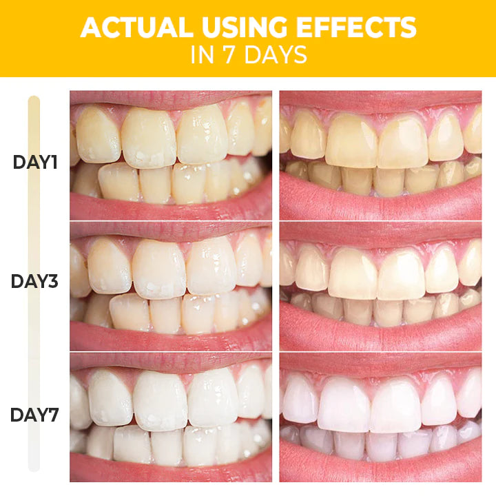 Skinetic™ Teeth Whitening Serum