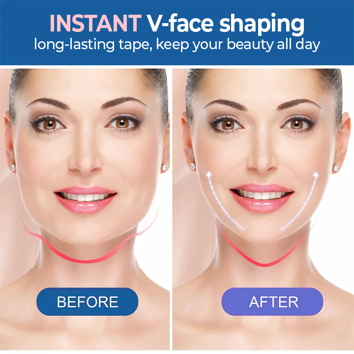 BeautyMAX™ V-Face Lifting Tape