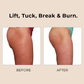 Sci-Effect™ Sonic Cellulite Buster
