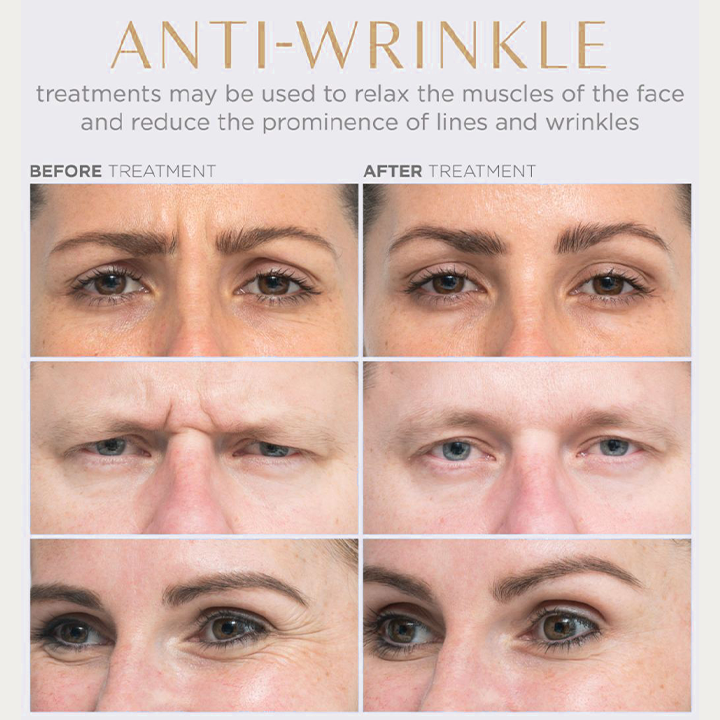 Clinical™ 3A Retinol Wrinkle Oil
