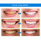 LIMETOW™ Teeth Whitening Essence